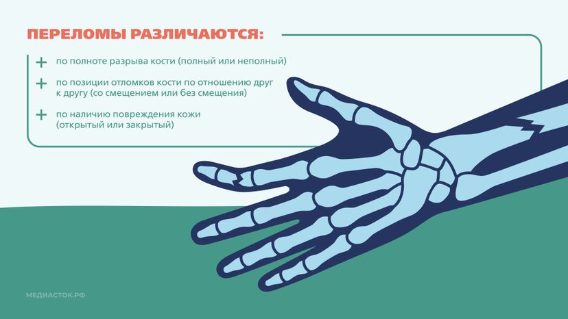 Первая помощь при переломах Горизонталь 03