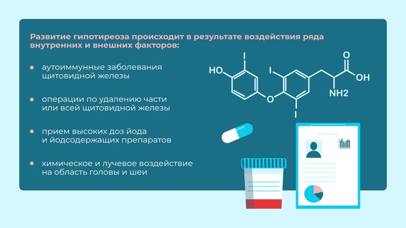 Заболевания щитовидной железы Горизонталь 04