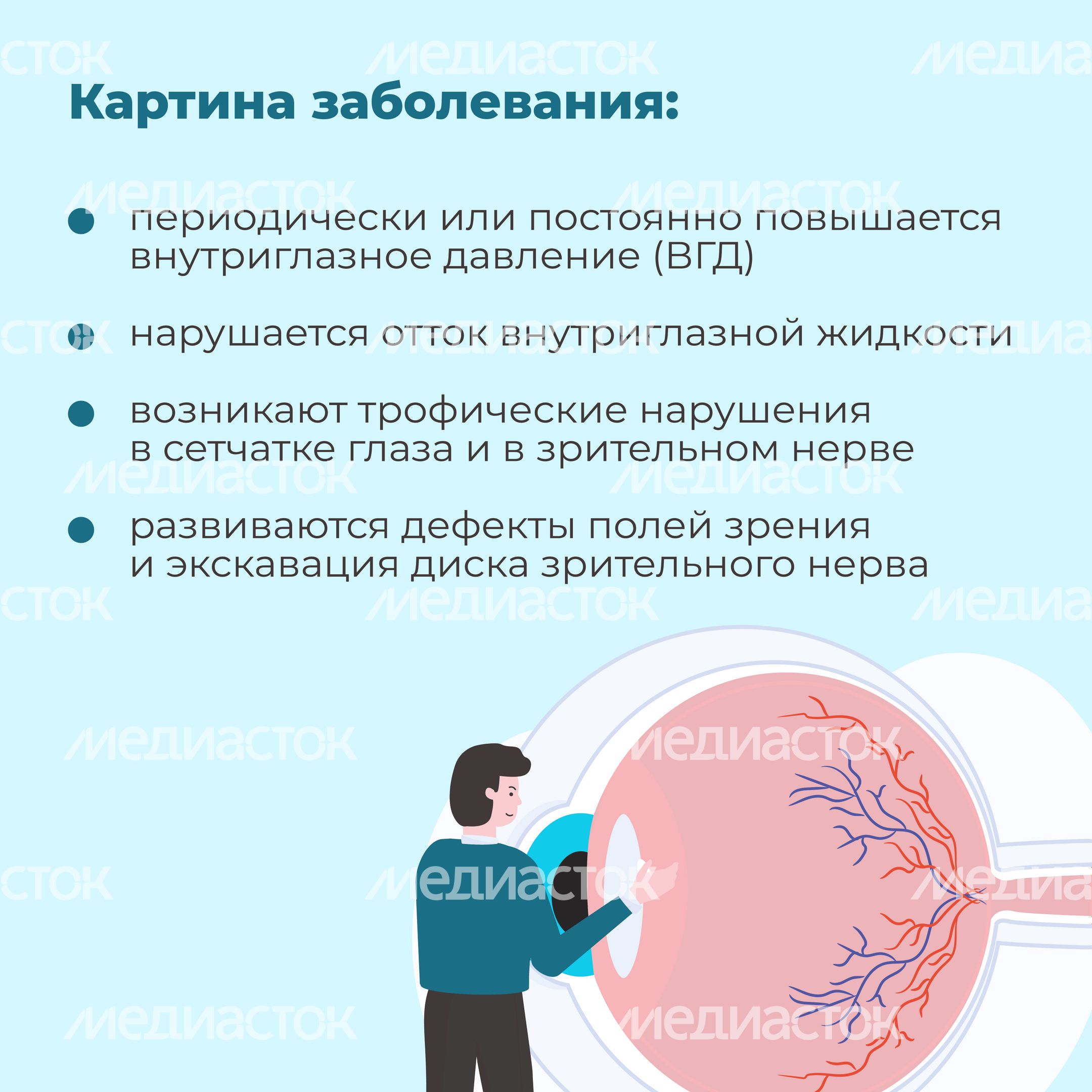 Глаукома-квадрат-03 Глаукома-квадрат-03