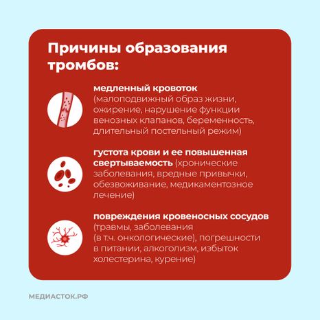 Тромбоз квадрат 04