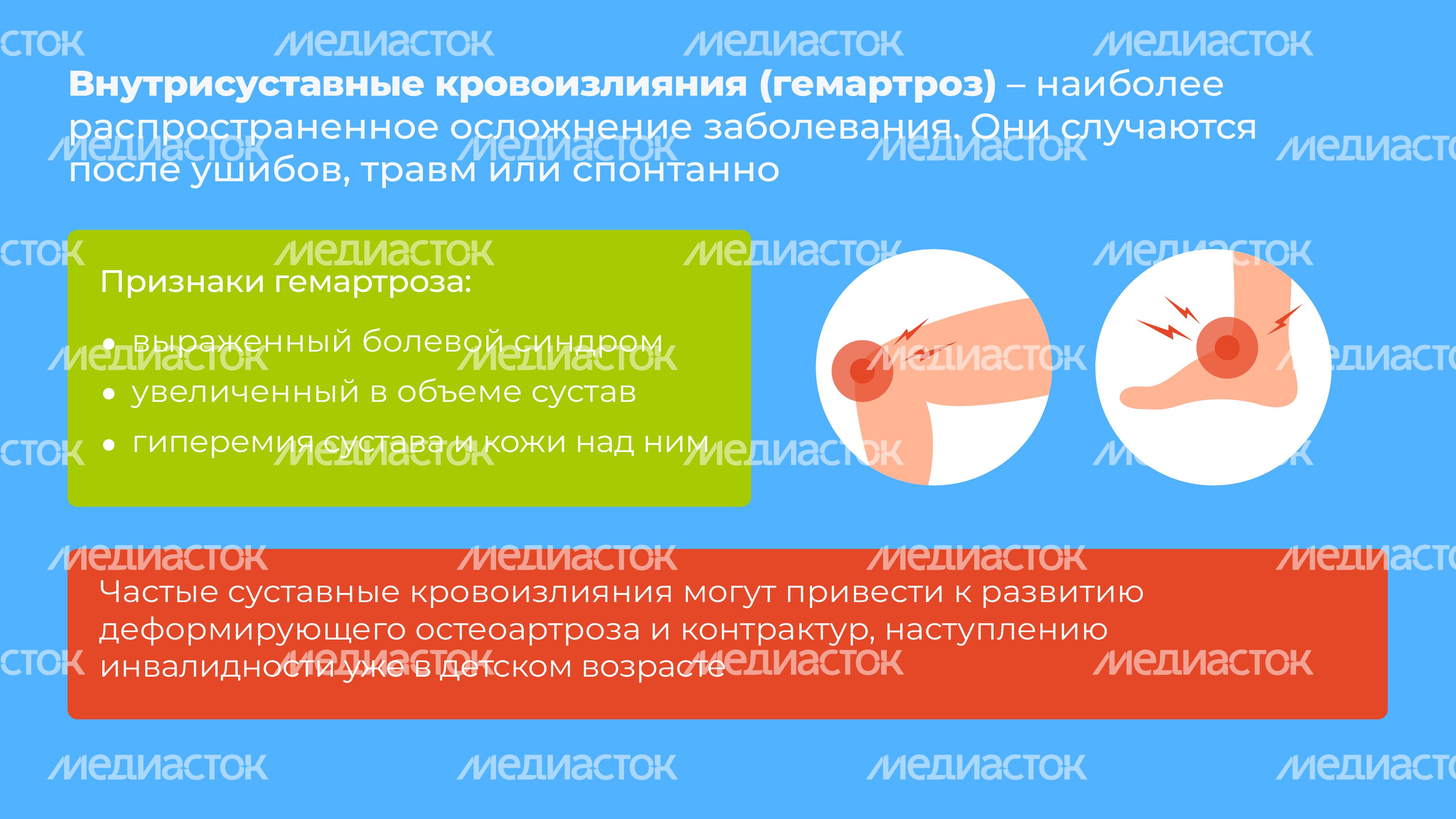 Гемофилия_горизонталь_8