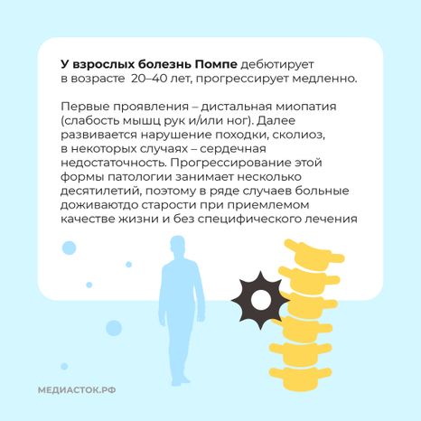 Болезнь Помпе квадрат 06