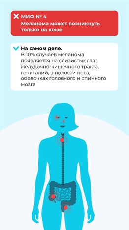 Правда и мифы о меланоме вертикаль (7)