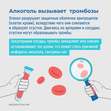 Как алкоголь влияет на сердце квадрат 06