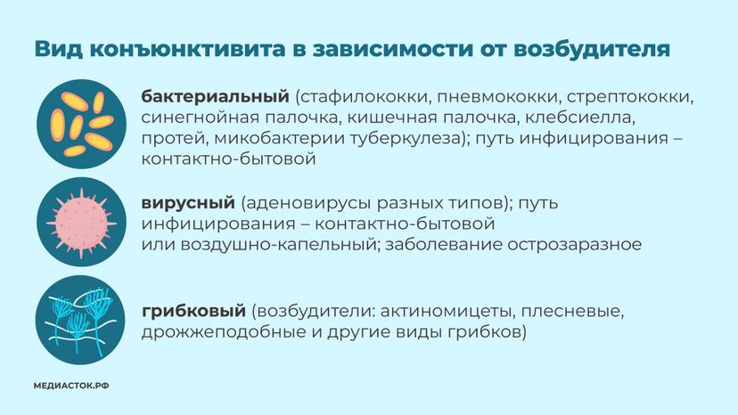Конъюнктивит горизонталь 04