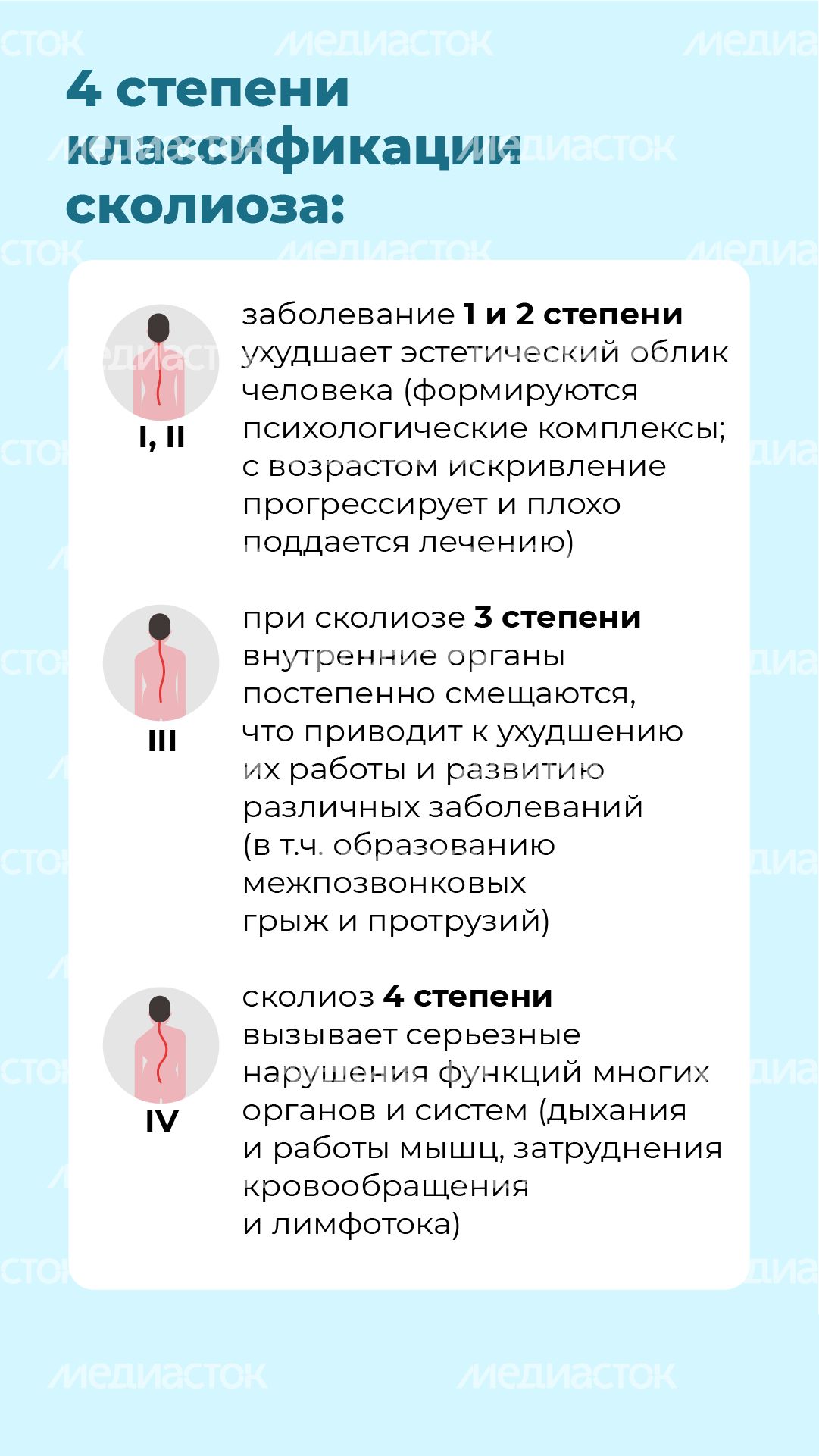 Чем опасен сколиоз вертикаль (5)