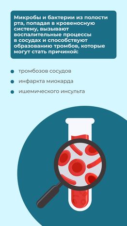 Кариес вертикаль 10