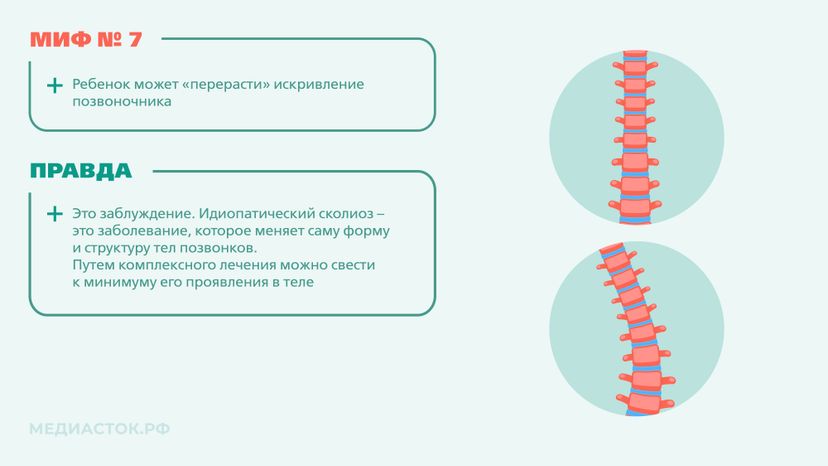 Идиопатический сколиоз мифы и правда горизонталь 07