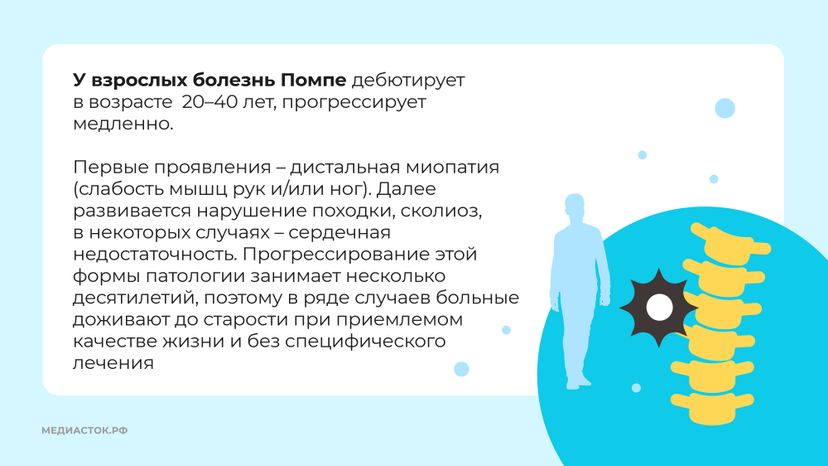 Болезнь Помпе горизонталь 06