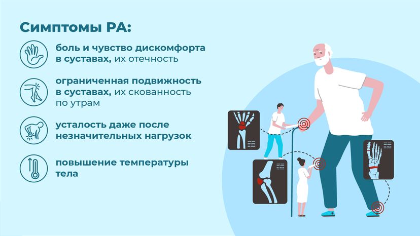 Ревматоидный артрит - горизонталь-05
