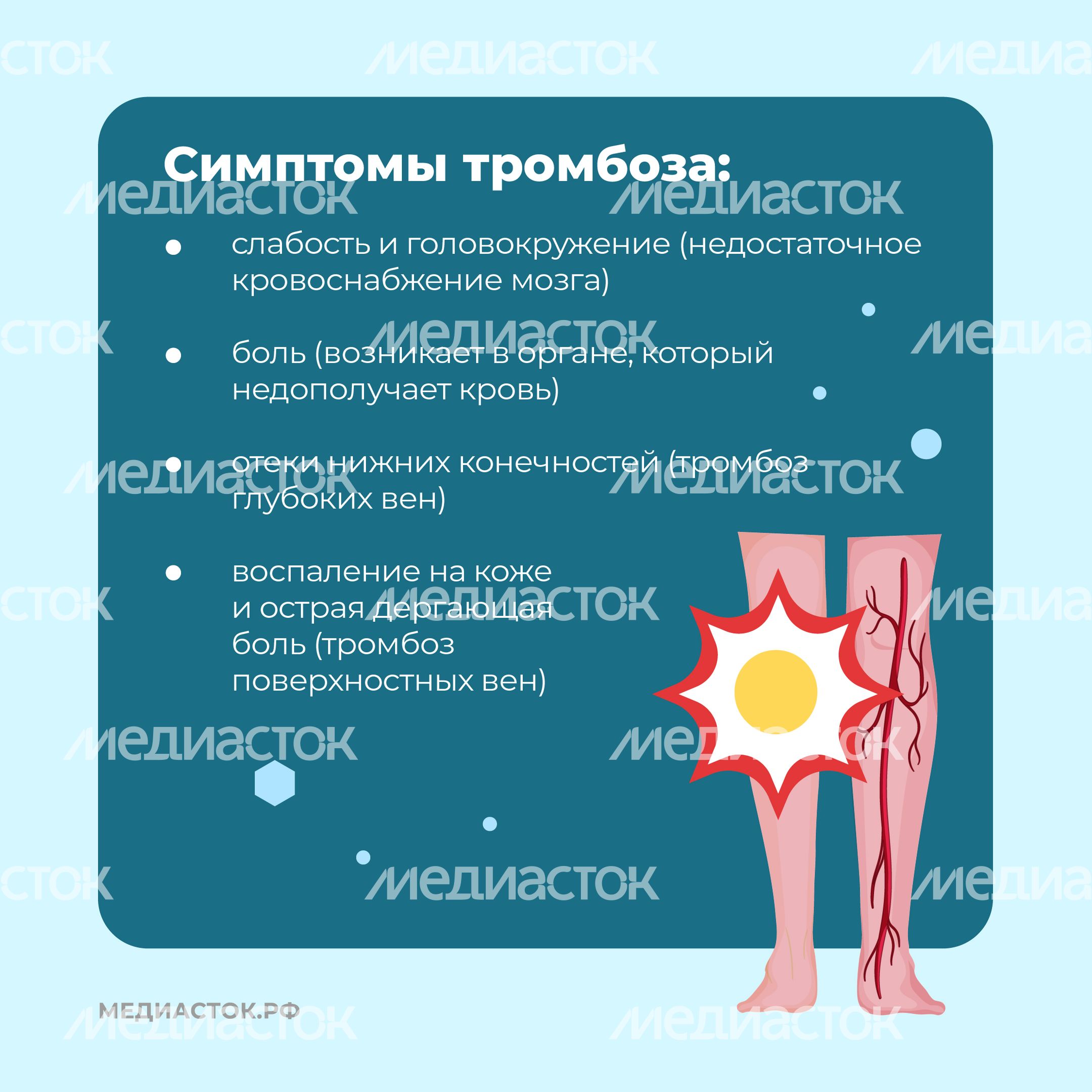 Тромбоз квадрат 06 Тромбоз квадрат 06
