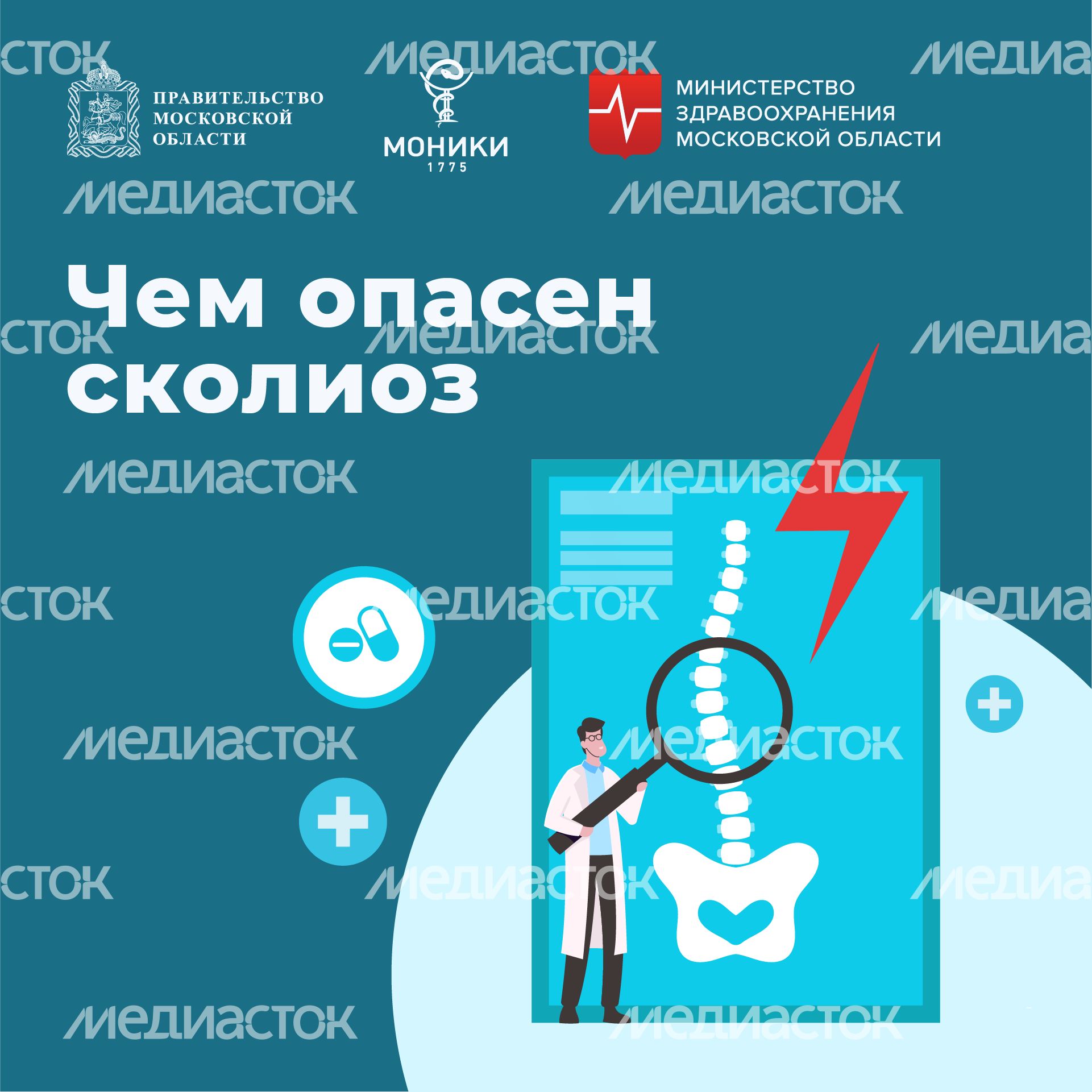 Чем опасен сколиоз квадрат (1) Чем опасен сколиоз квадрат (1)