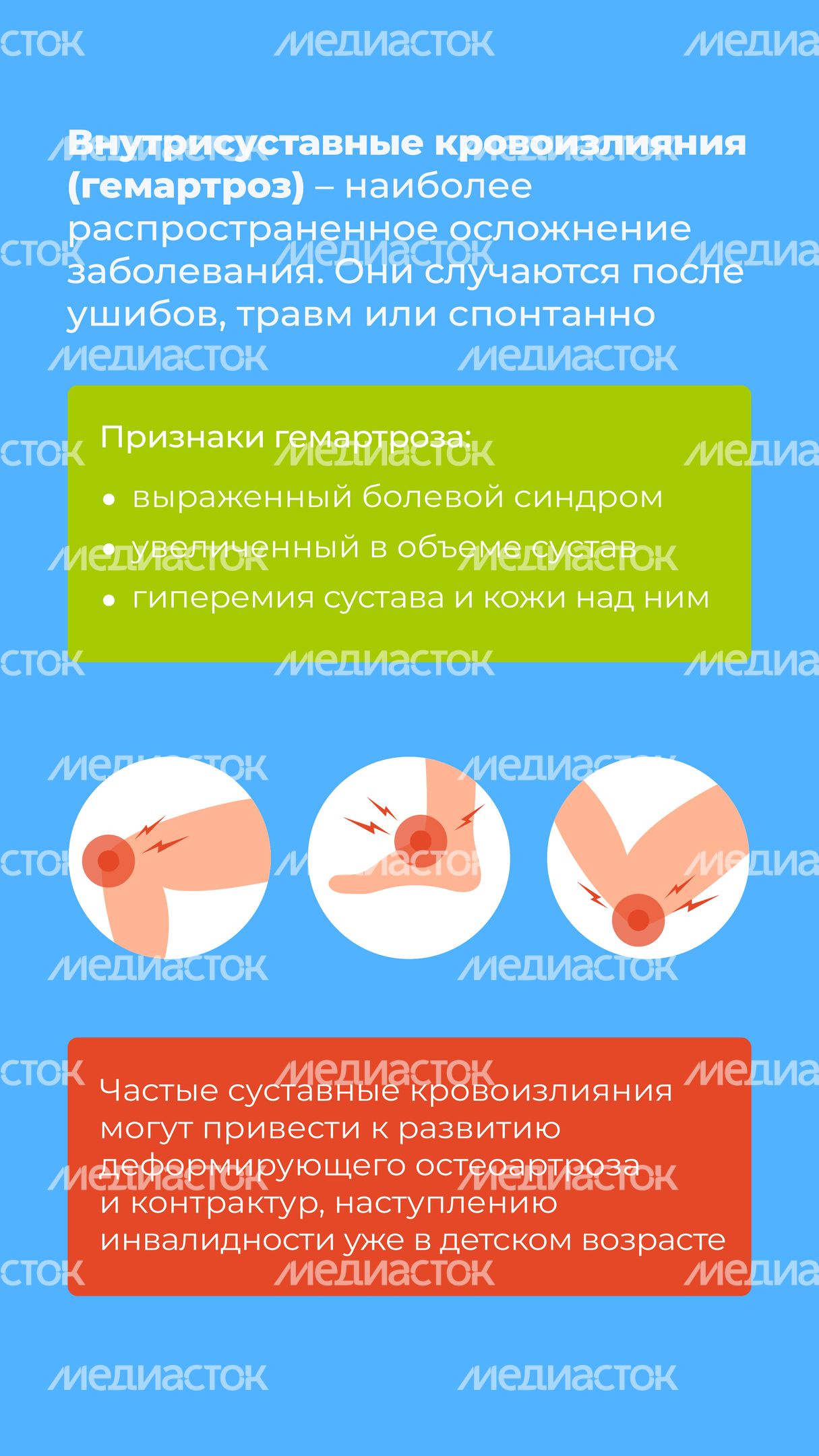 Гемофилия_вертикаль_8