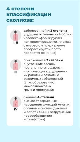 Чем опасен сколиоз вертикаль (5)