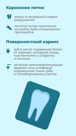 Кариес вертикаль 04
