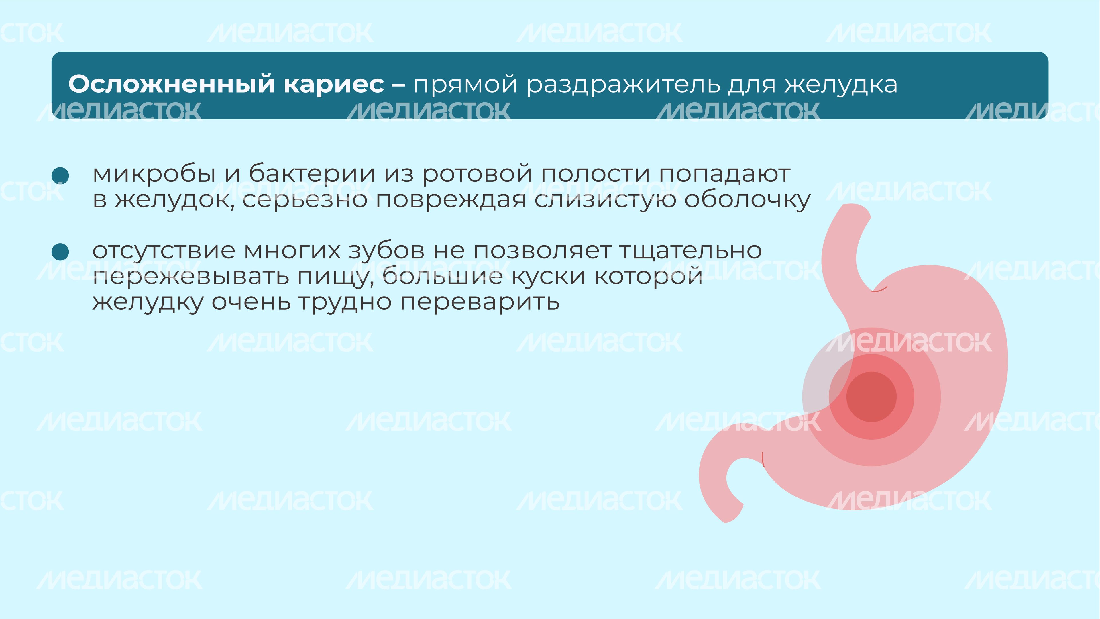 Кариес горизонталь 07 Кариес горизонталь 07