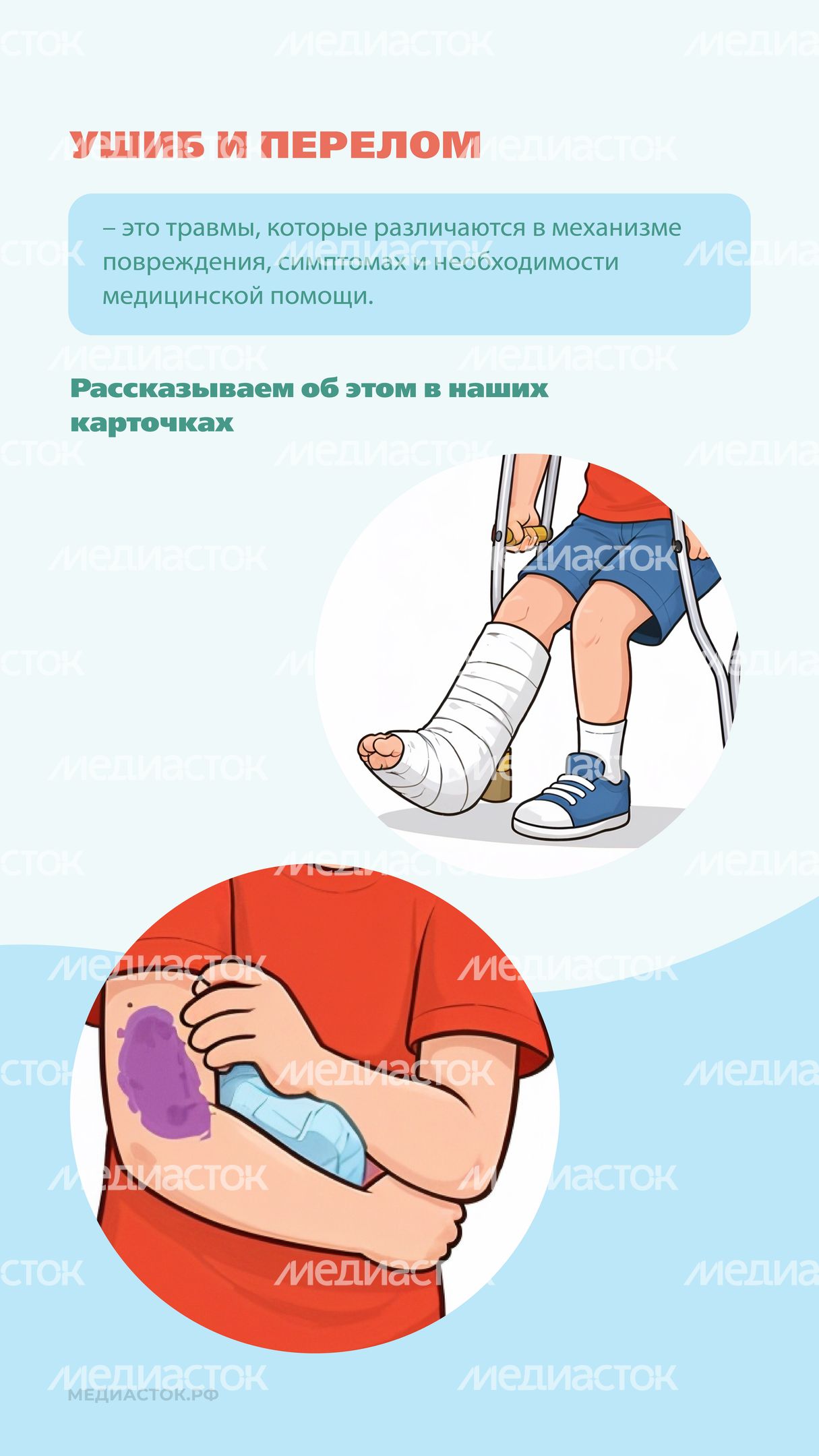 Перелом или ушиб Вертикаль 02 Перелом или ушиб Вертикаль 02