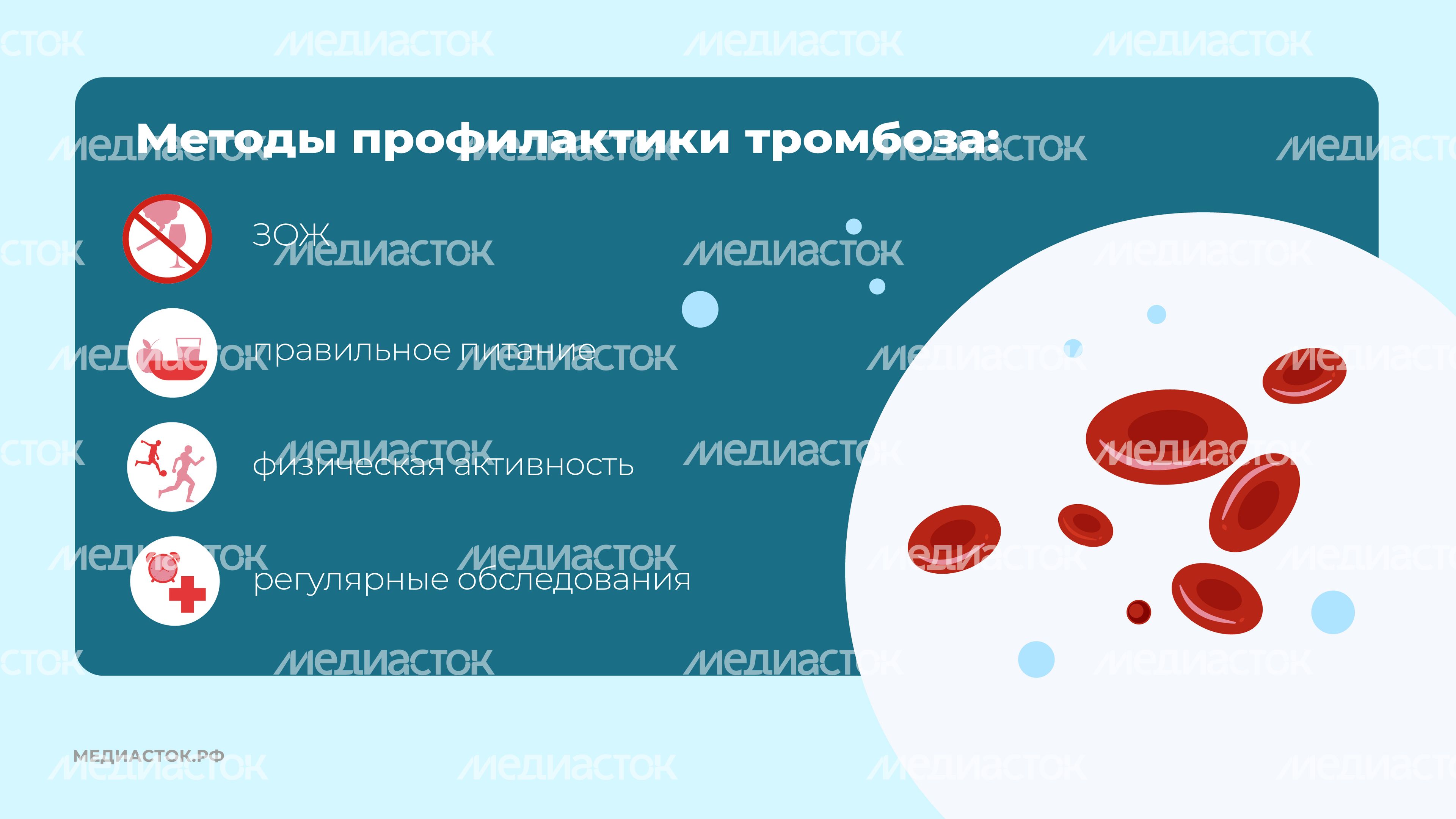 Тромбоз горизонталь 07 Тромбоз горизонталь 07
