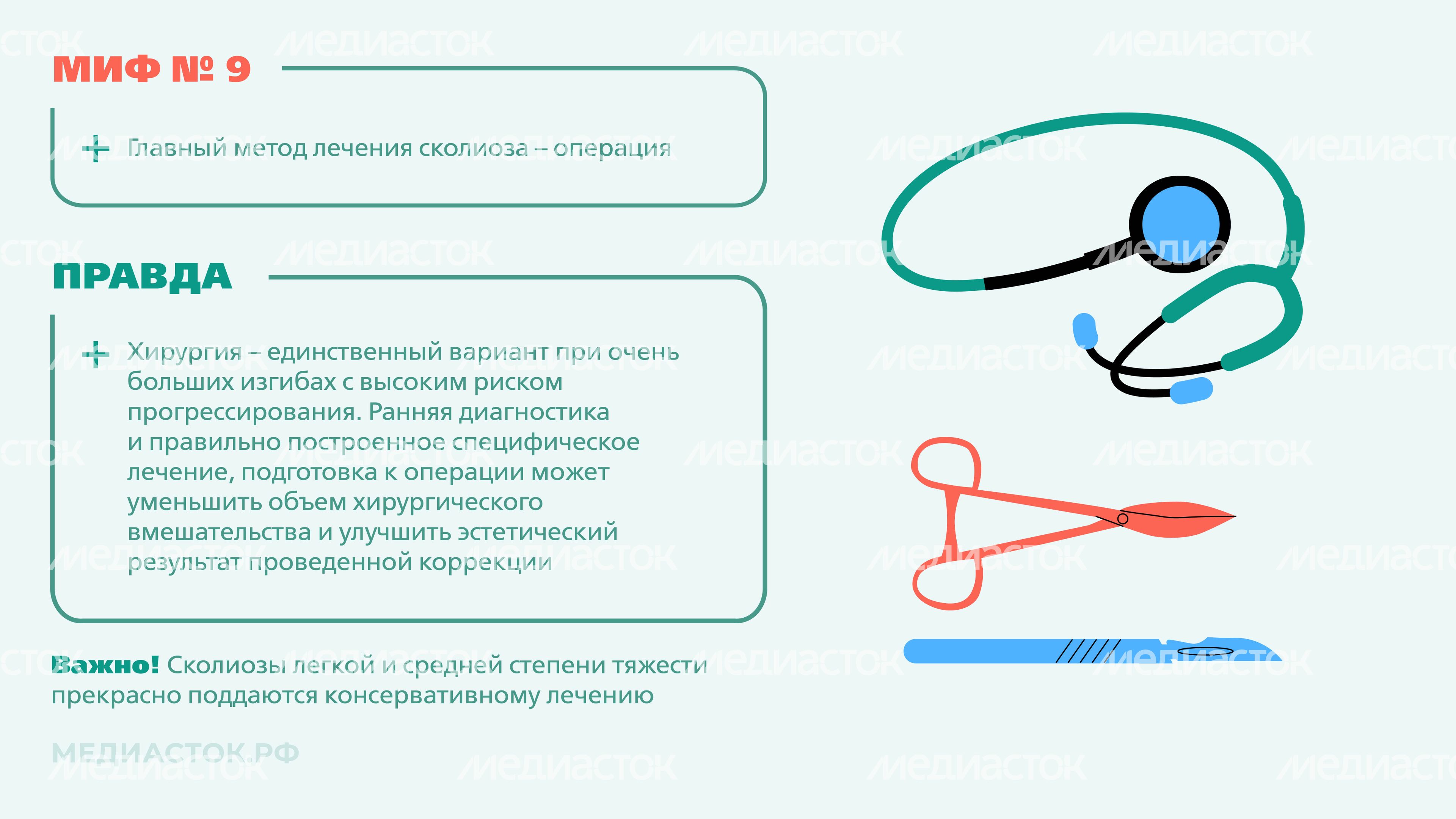 Идиопатический сколиоз мифы и правда горизонталь 09