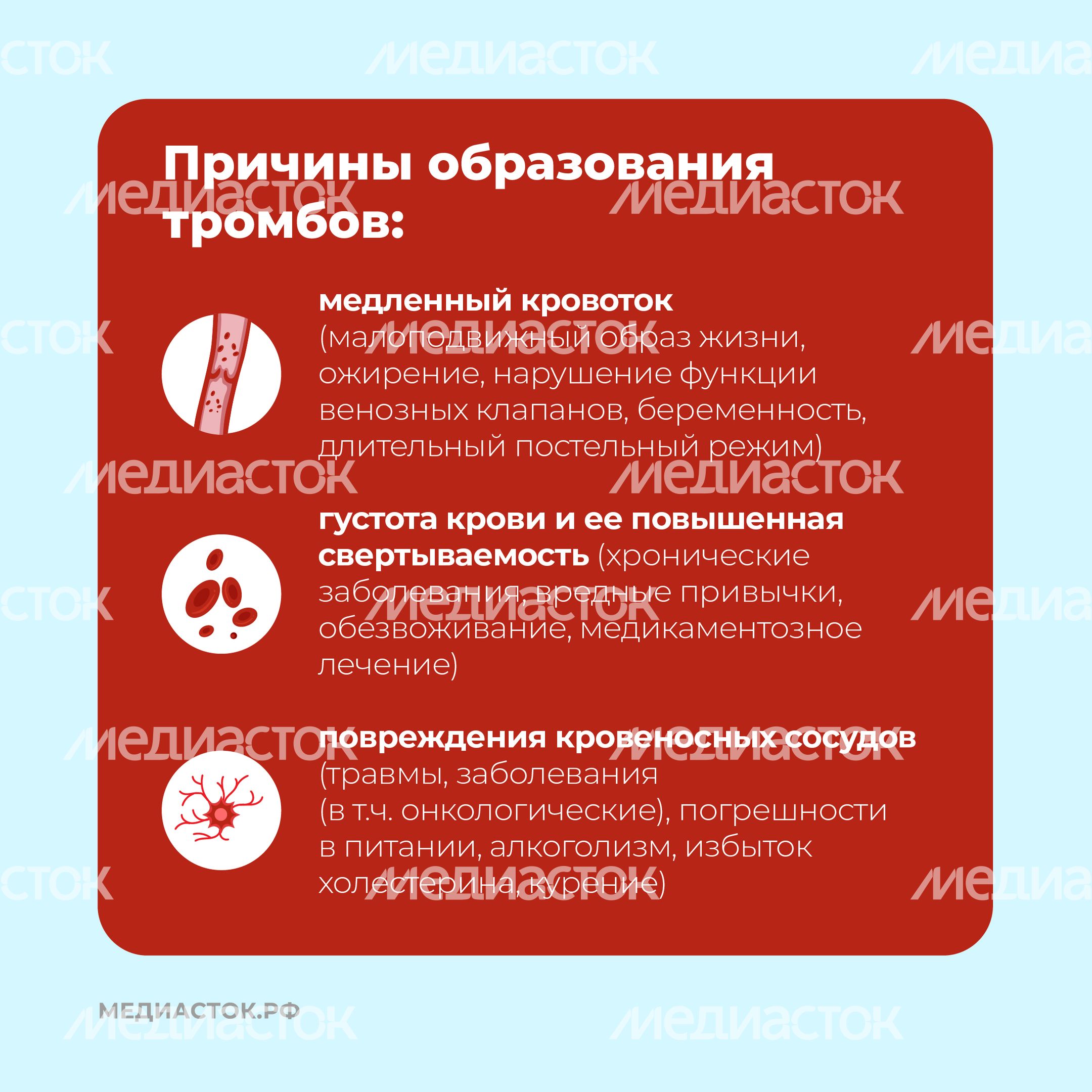Тромбоз квадрат 04