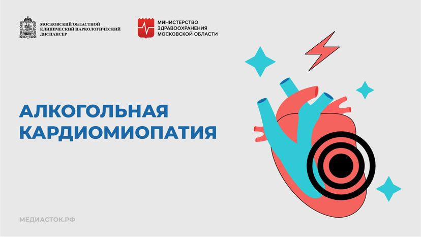 Алкогольная кардиомиопатия горизонталь 01
