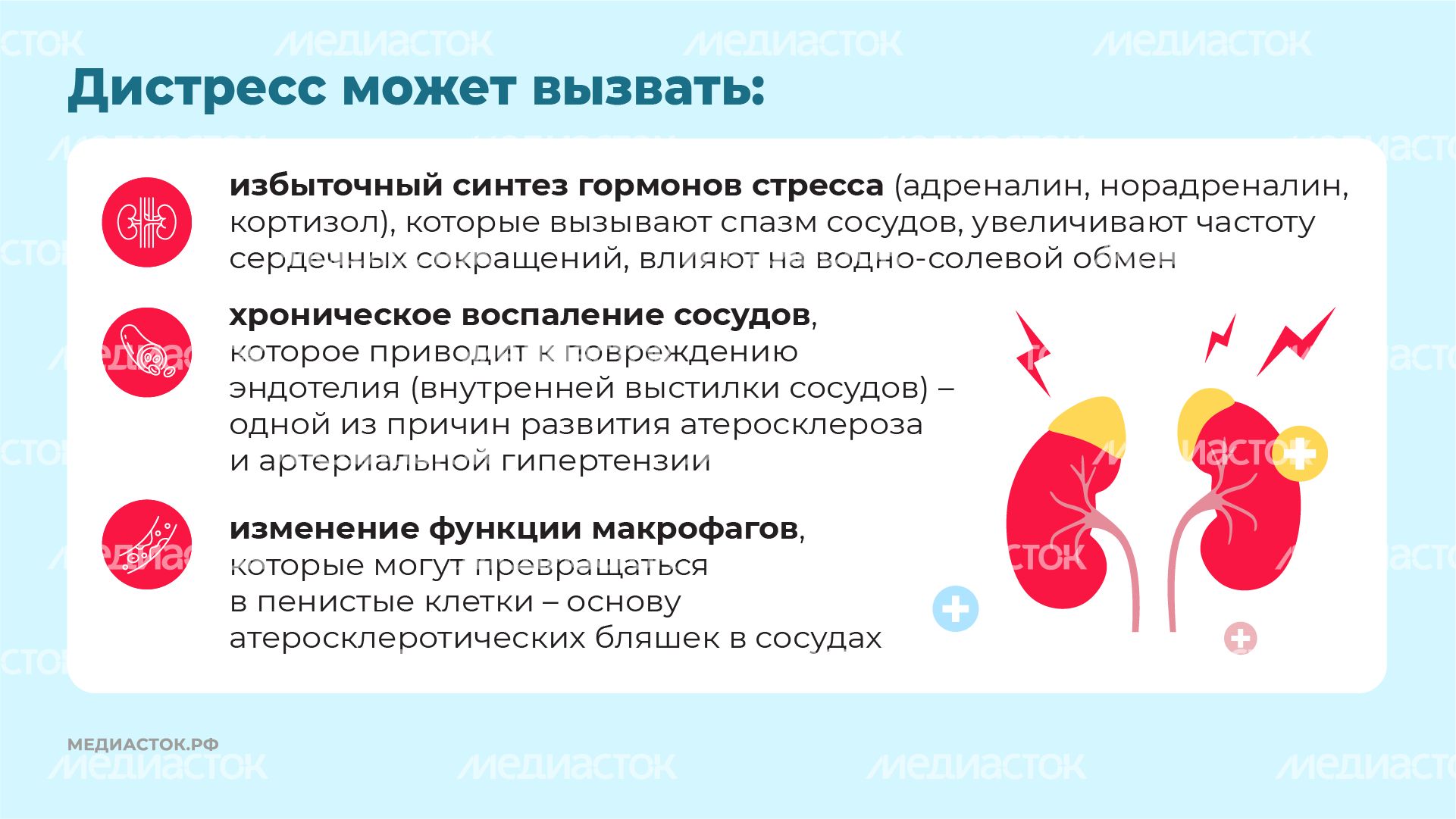 Стресс горизонталь 05 Стресс горизонталь 05
