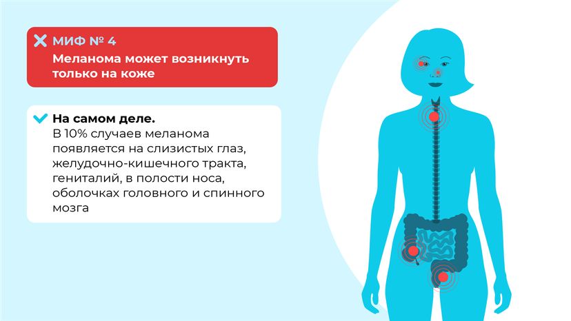 Правда и мифы о меланоме горизонталь (7)