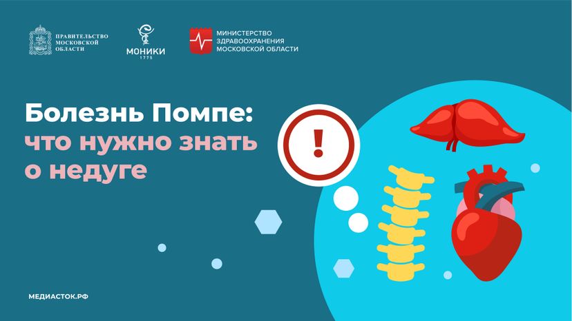 Болезнь Помпе горизонталь 01