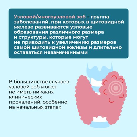 Заболевания щитовидной железы Квадрат 08