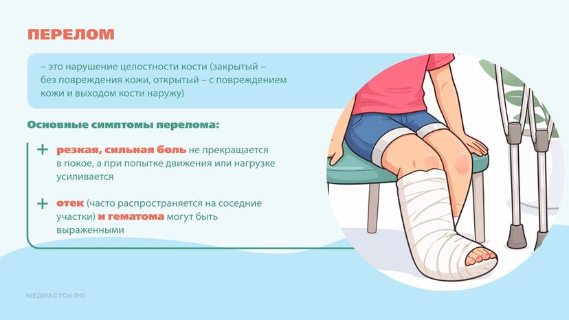 Перелом или ушиб Горизонталь 05
