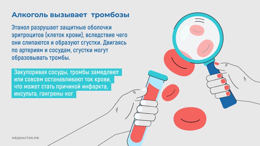 Как алкоголь влияет на сердце горизонталь 06