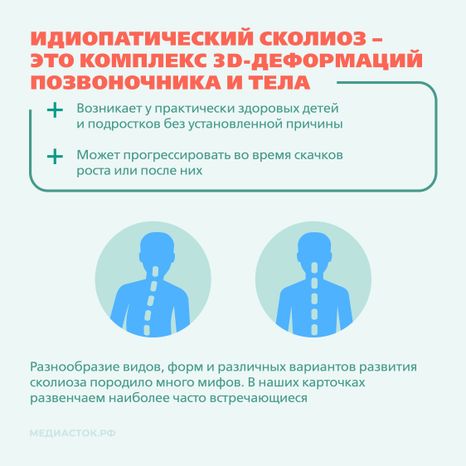 Идиопатический сколиоз мифы и правда квадрат 02