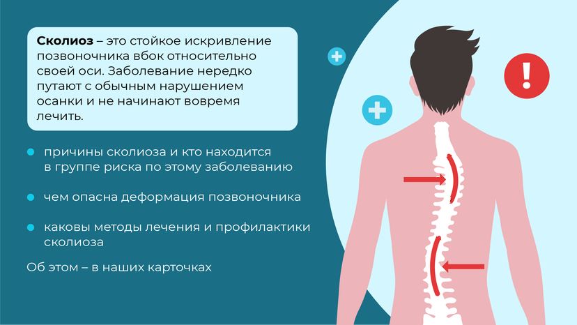 Чем опасен сколиоз горизонталь (2)