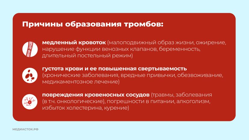 Тромбоз горизонталь 04