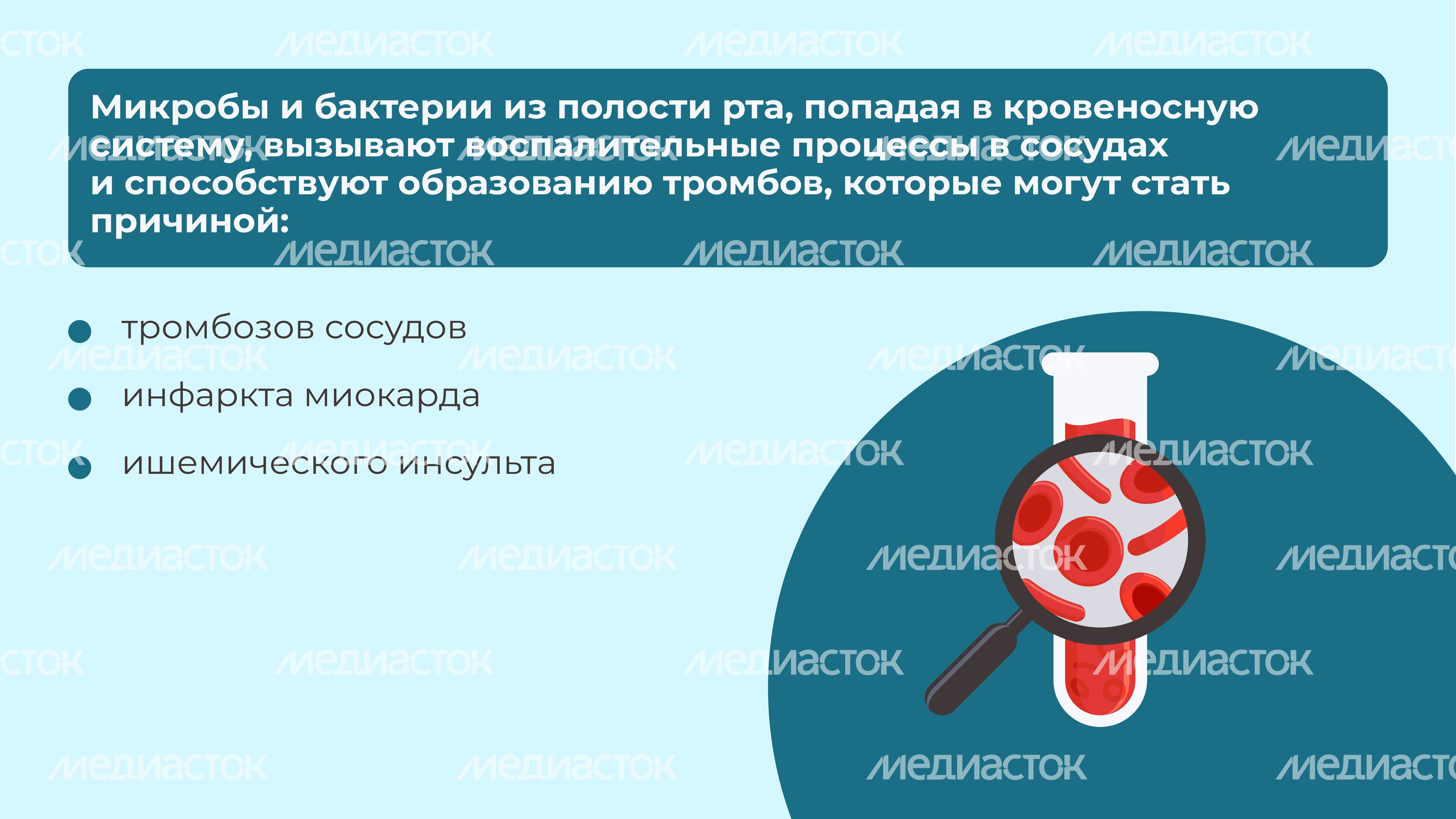Кариес горизонталь 10 Кариес горизонталь 10