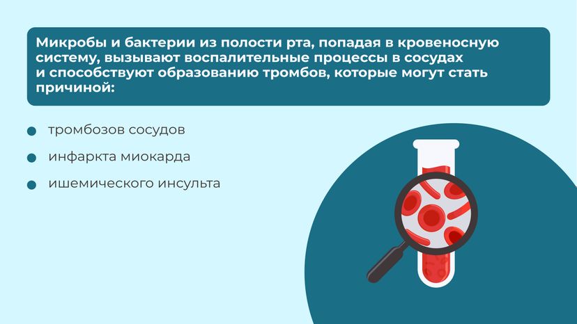 Кариес горизонталь 10