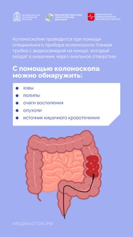 Колоноскопия вертикаль 03