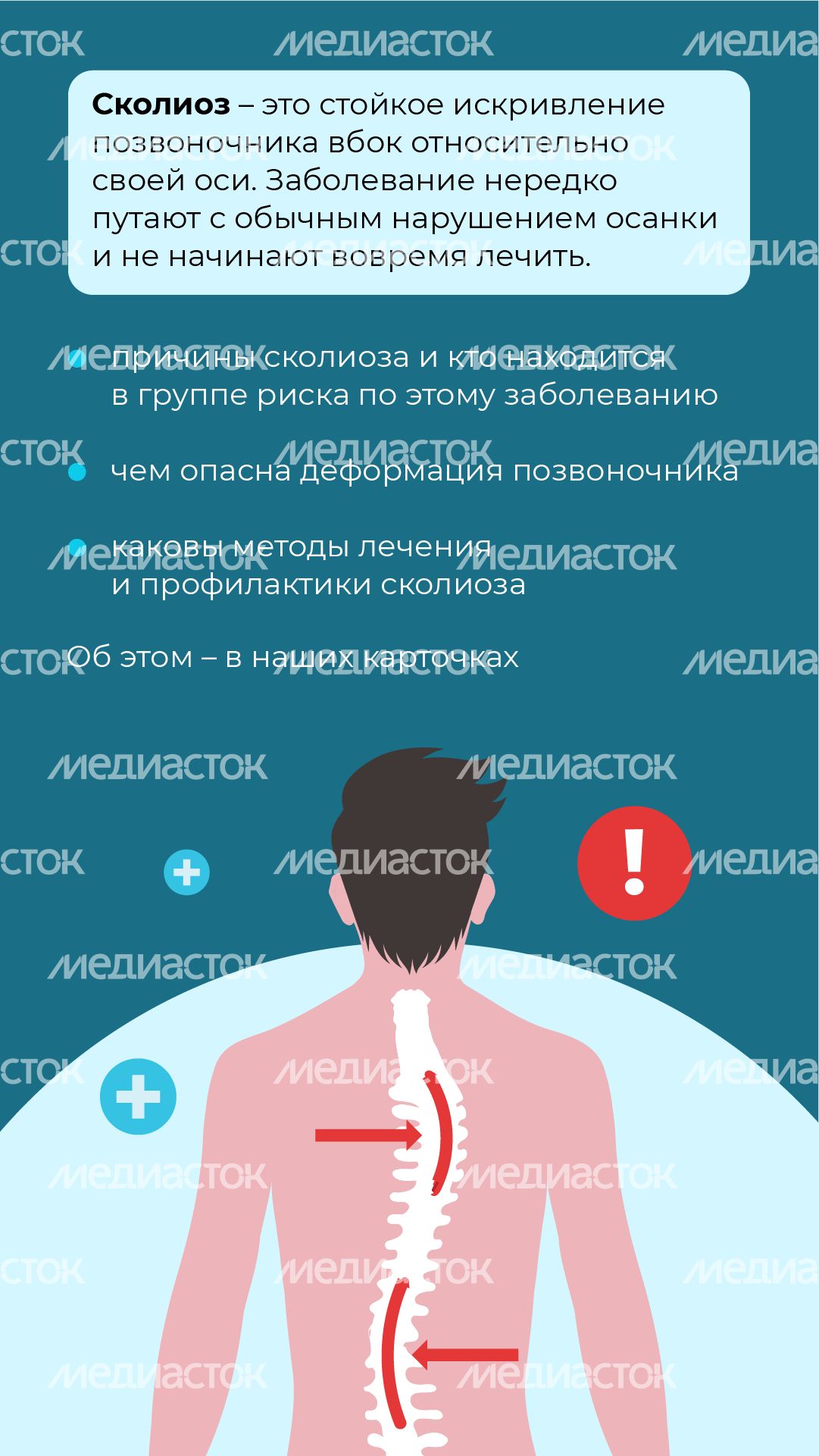 Чем опасен сколиоз вертикаль (2)