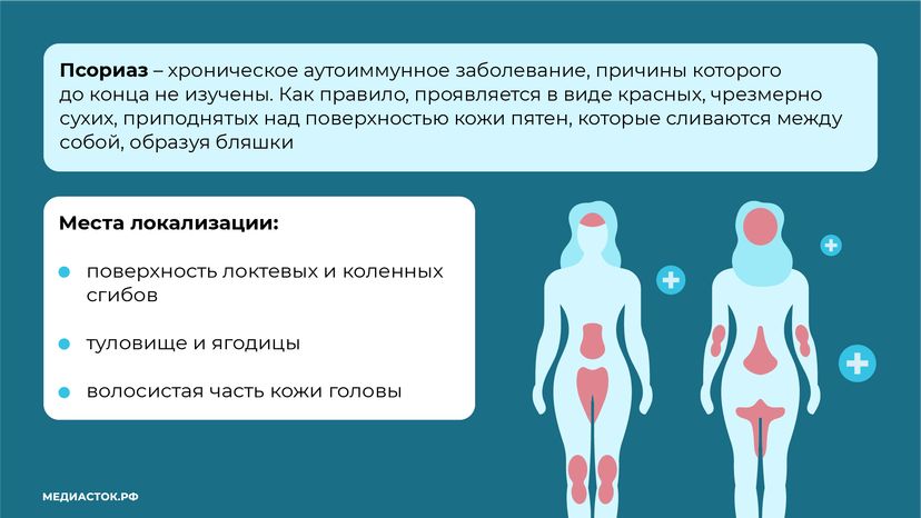 7 мифов о псориазе горизонталь (3)