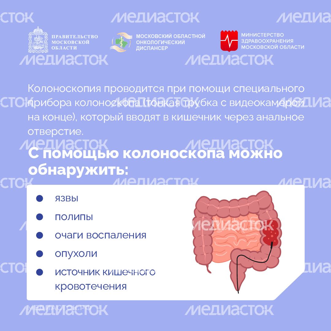 Колоноскопия квадрат 03 Колоноскопия квадрат 03