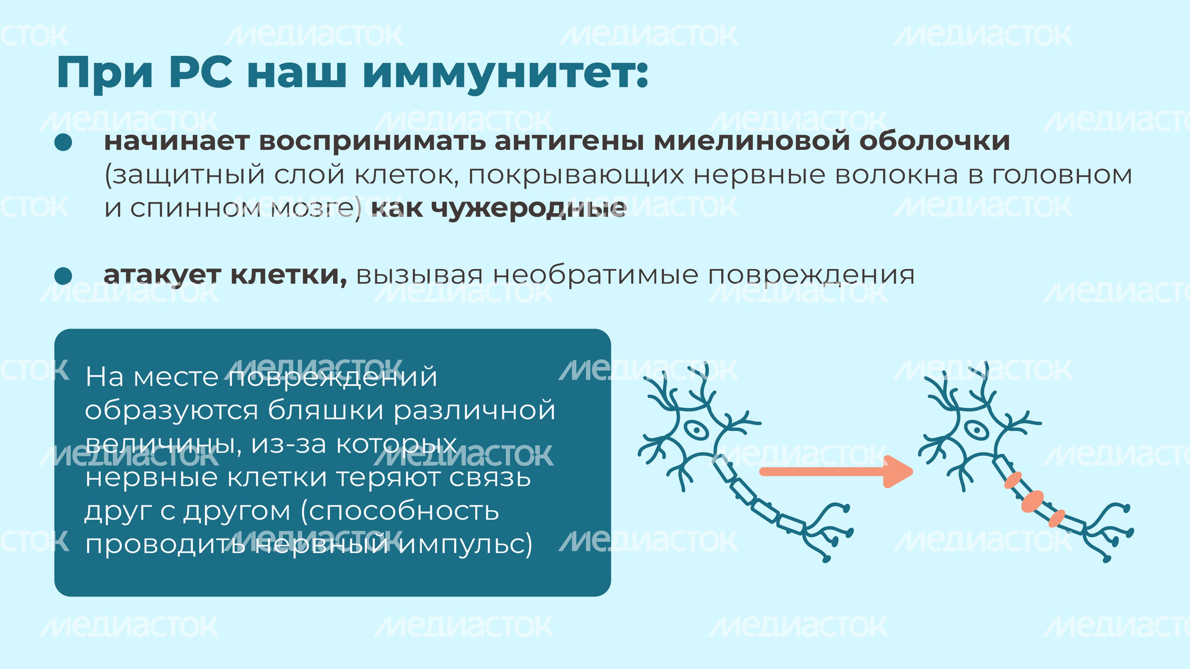 Рассеянный склероз горизонталь 03 Рассеянный склероз горизонталь 03
