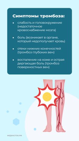 Тромбоз вертикаль 06