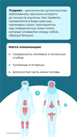 7 мифов о псориазе вертикаль (3)