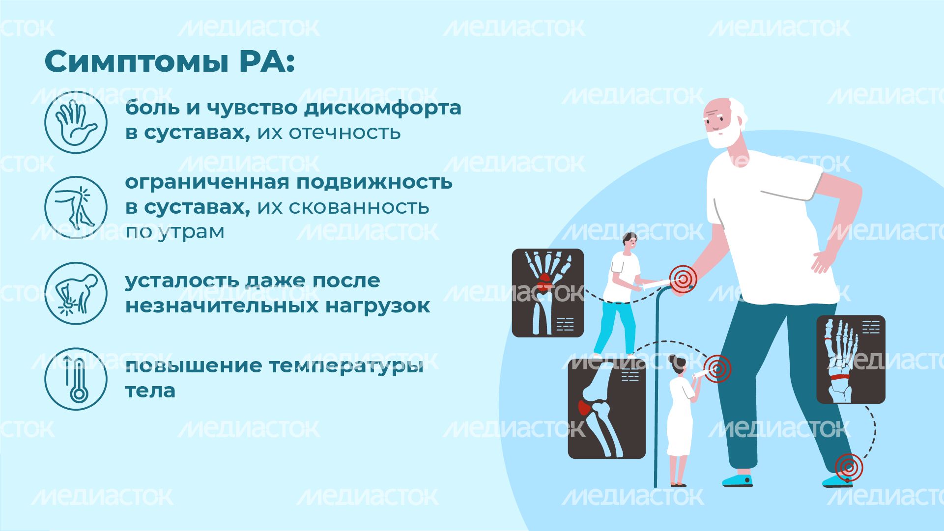 Ревматоидный артрит - горизонталь-05