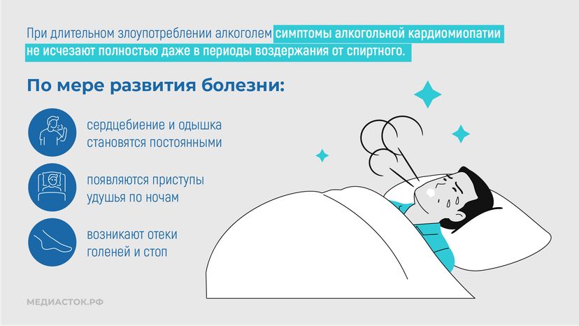 Алкогольная кардиомиопатия горизонталь 07