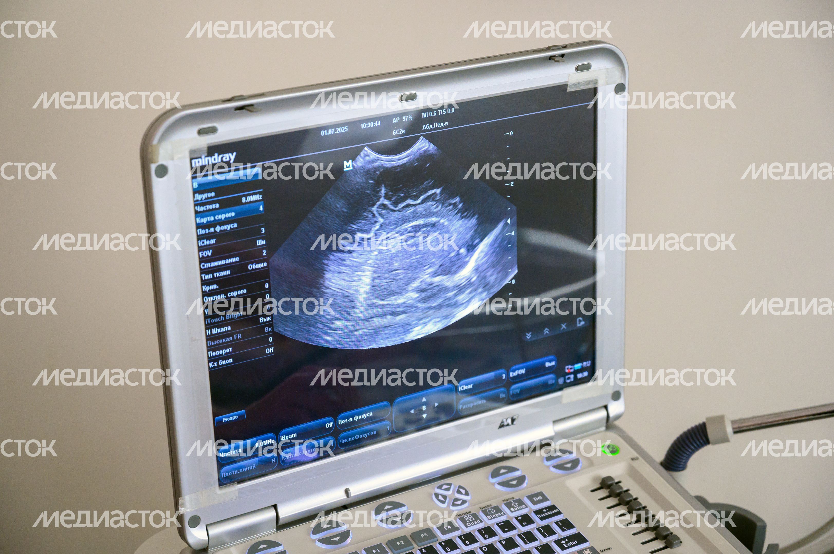 Неонатальный скрининг новорожденных в Областном Центре материнства и детства г. Раменское Неонатальный скрининг новорожденных в Областном Центре материнства и детства г. Раменское